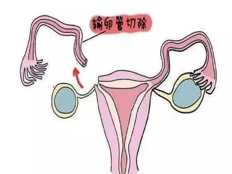 有阴道炎容易怀孕吗